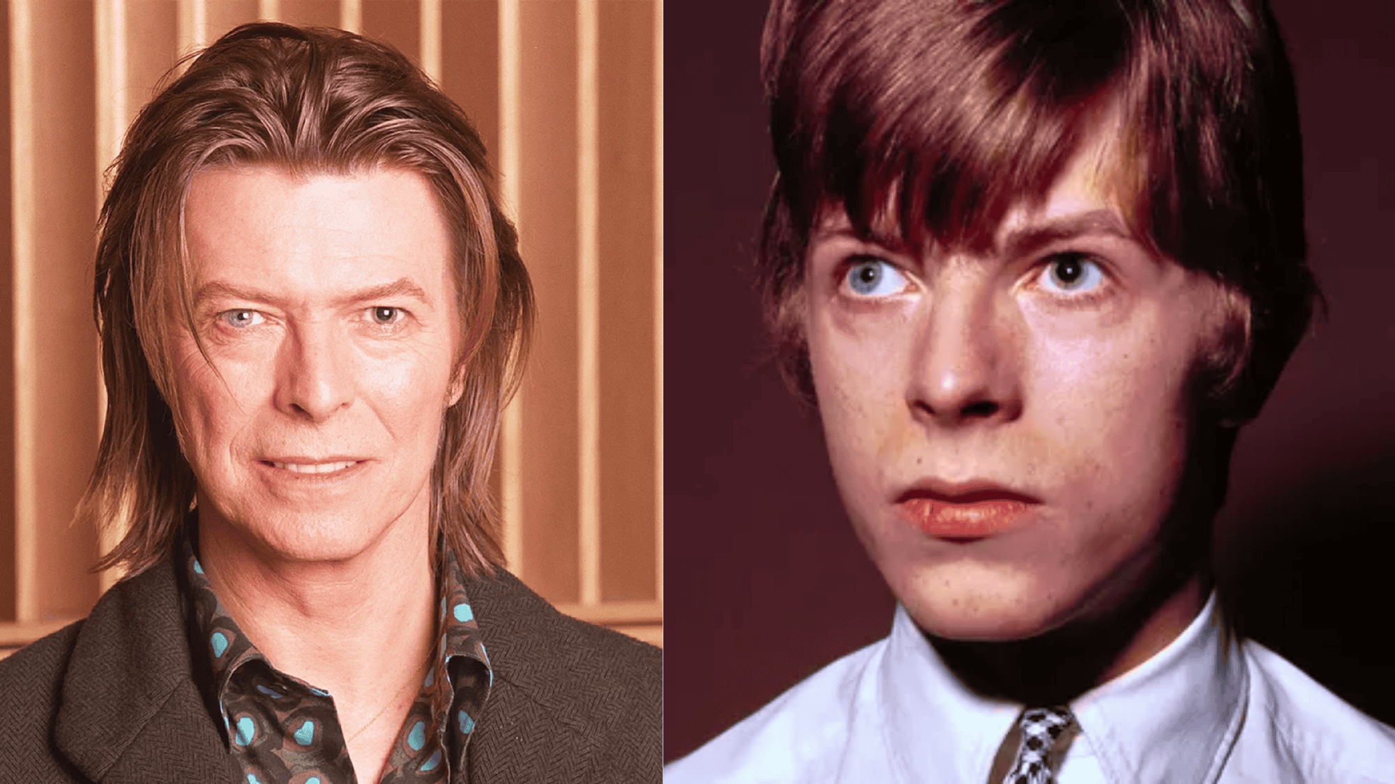 How did David Bowie get this Eye Condition?