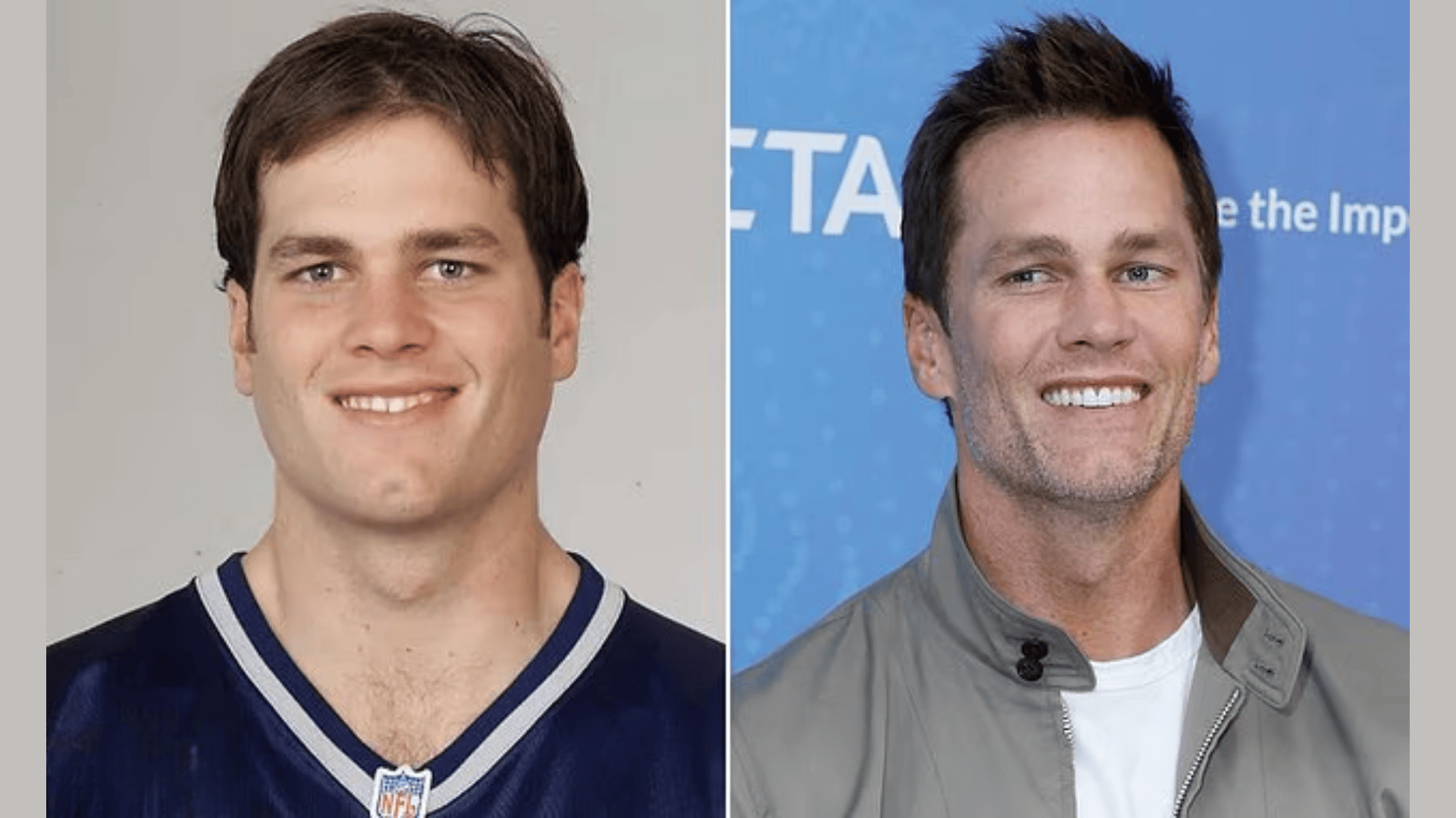tom brady surgery before and after (1)