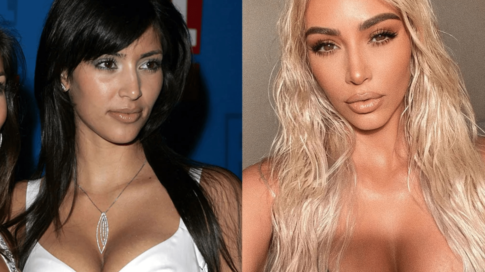 kim kardashian before surgery